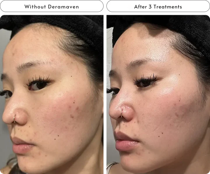 Improve Your Skins Tone & Texture