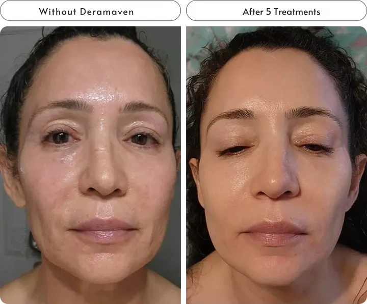 Boost Your Skins Glow & Radiance